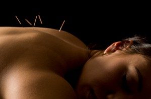 asthma-acupuncture